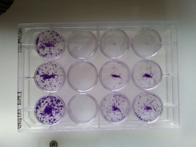 The purple dots represent how effective certain treatments are for breast cancer. Senior Kayla Bynion tested and recorded her findings in a cancer research lab at the John Hopkins University for her Senior Project.