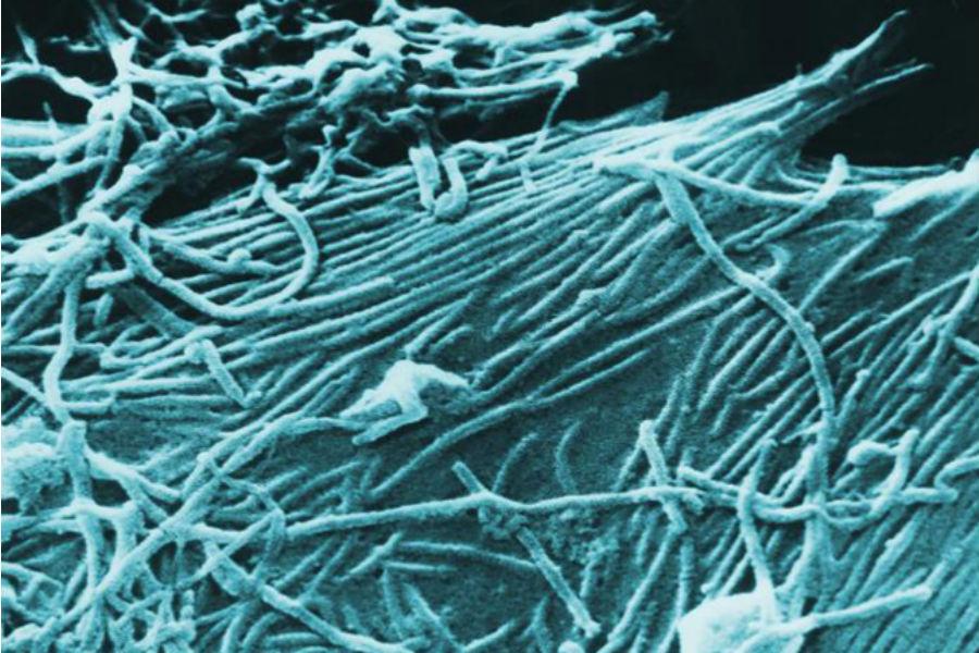 Scanning electron microscopic image of Ebola virions.